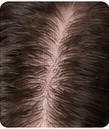 Healthy Scalp