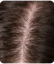Healthy Scalp