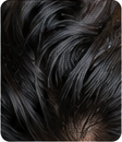 Dark Hair Scalp