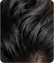 Dark Hair Scalp