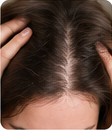 Hair Density