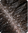 Severe Flaking